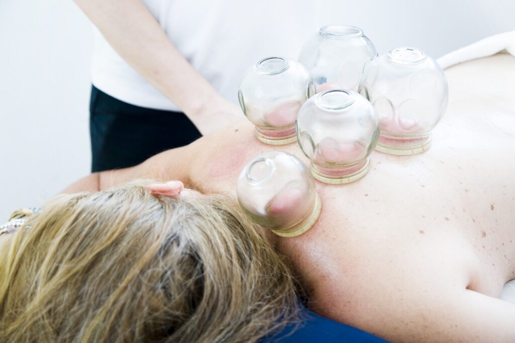 cupping therapy, cupping massage, massage, alternative medicine, chinese traditional medicine, cupping therapy, cupping therapy, cupping therapy, cupping therapy, cupping therapy